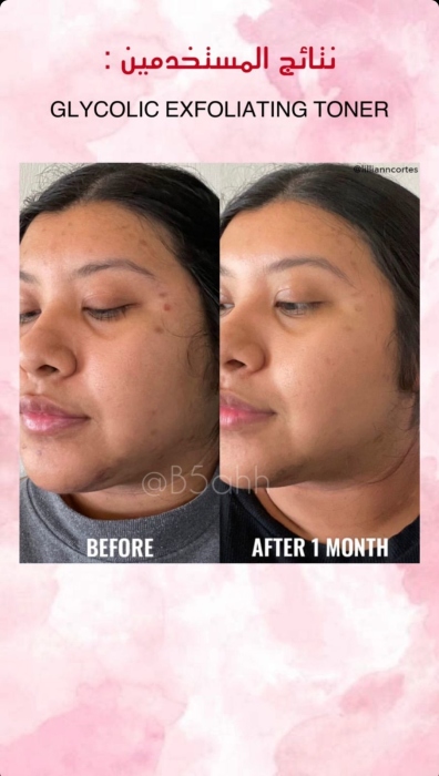 Good molecules, GLYCOLIC EXFOLIATING TONER  جود موليكيولز، تونر حمض الجليكوليك للتقشير 